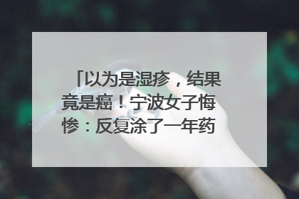 以为是湿疹，结果竟是癌！宁波女子悔惨：反复涂了一年药膏都没好！很多患者首诊都去了皮肤科