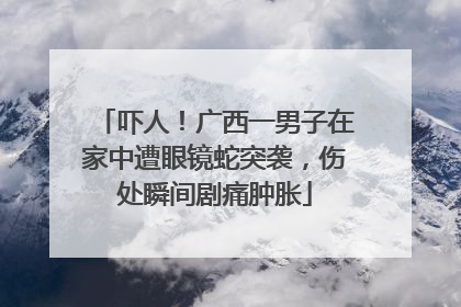 吓人！广西一男子在家中遭眼镜蛇突袭，伤处瞬间剧痛肿胀
